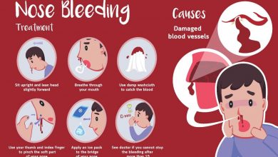 causes-of-nosebleeds-in-heat