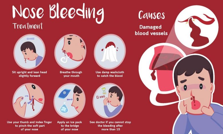 causes-of-nosebleeds-in-heat
