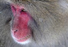 colorectal-cancer-expert-insights