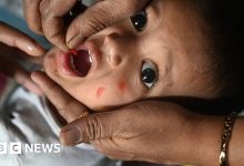 measles-outbreak-in-ratlam