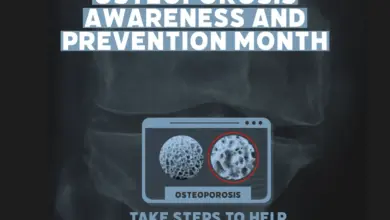 women-bone-health-concerns