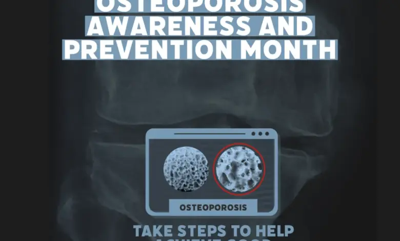 women-bone-health-concerns